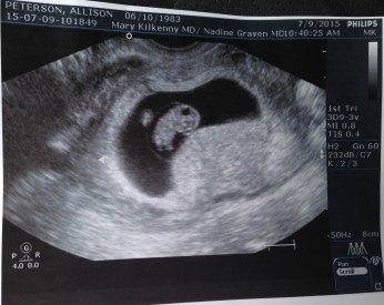 Baby #3 at 8 weeks